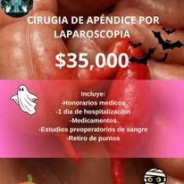 Promoción de cirugía de apéndice por laparoscopia