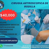Cirugía artroscópica de rodilla